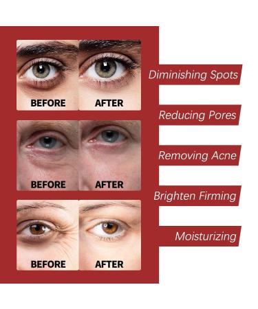 AMALIA Retinol Collagen Complex Day & Night Cream Anti-Aging Formula with Hyaluronic Acid 1.06 oz - Buy Online on GoSupps.com