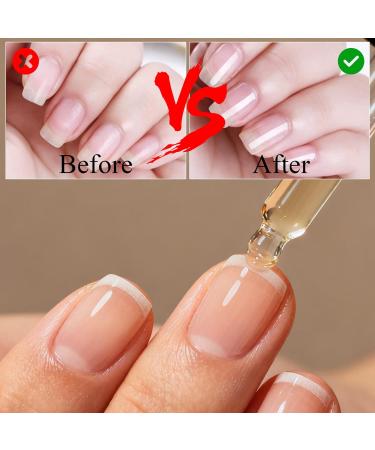 Huile Cuticules Ongles BIO 2pcs Huile Revitalisante Cuticules Manucure Huile de Soin pour Les Ongles de 15 ml Pour Une Qualit Salon La Maison Soin Quotidien Post Manucure Mains Douces - Buy Online on GoSupps.com