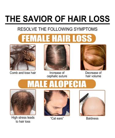 Fermented Rice Water Hair Growth Serum & Repair Essential Oil - For Hair Thinning, Regrowth Treatment - Buy Online on GoSupps.com