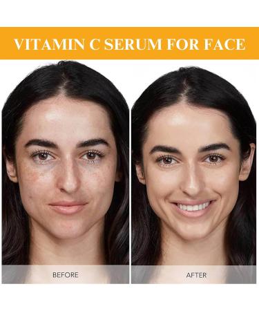 Trendyfave 20% Vitamin C Serum For Face Vitamin C Serum With Hyaluronic Acid Vit C Serum Face Hydrating Face Serum Hydrating & Plump Skin 2FL.OZ - Buy Online on GoSupps.com