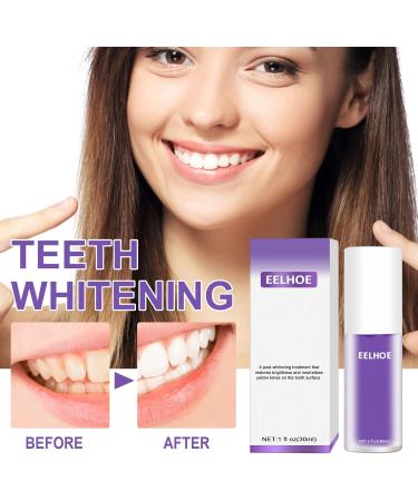 Purple Teeth Whitening Toothpaste | Intensive Stain Removal & Cleansing Paste (2PCs) - Brighten Your Smile Today! - Buy Online on GoSupps.com