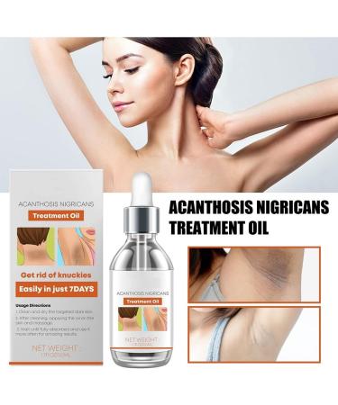  RUCRAK 2 pcs Acanthosis Nigricans Therapy Oil Dark Spot Corrector Oil Remover Lighten Body Black Skin Permanent Whitening - Buy Online on GoSupps.com