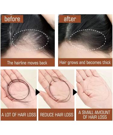 120ml Hair Butter with Raw Batana Oil Batana Oil for Hair Growth Batana Oil for Healthy Hair Batana Oil Hair Treatment for All Hair Types Promotes Hair Strength & Resilience Repair Damaged Hair - Buy Online on GoSupps.com