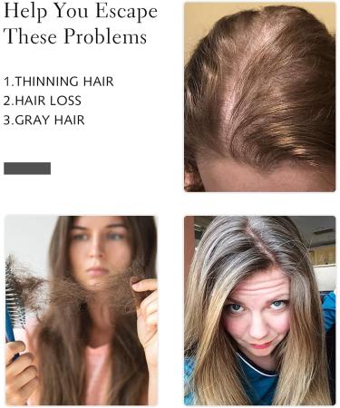 Yamel Honey Blonde Synthetic Hair Topper for Women- 3 Clip-in Hair Pieces for Thinning Hair - Buy Online on GoSupps.com