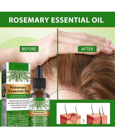 Organic Rosemary Hair Oil Combo - 4-Pack for Hair Growth & Scalp Massage | Natural Essential Oils for Skin Care & Aromatherapy - Buy Online on GoSupps.com