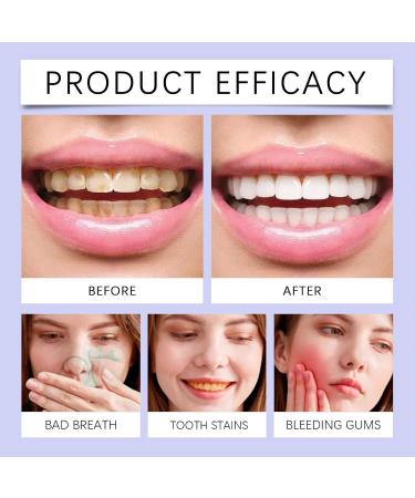 KLYso Advanced Oral Care Whitening Toothpaste for Fresh Breath & Healthy Gums Deeply Clean Teeth & Remove Stains Gentle Formula for Daily Use(1PCS) - Buy Online on GoSupps.com