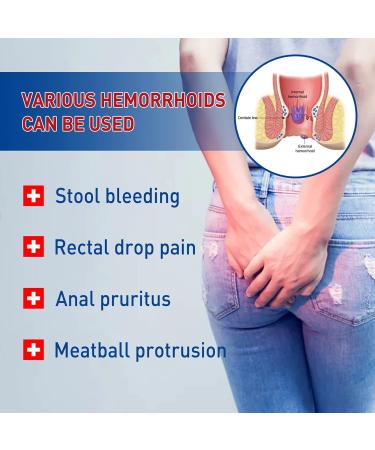 Hemorrhoid Cream - Fast Relief for Itching and Swelling - Ideal for Drivers, Office Workers and Pregnant Women - Buy Online on GoSupps.com