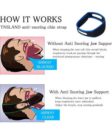 Anti-Snoring Chin Strap | 2022 Snoring Solution for Men & Women | Snoring Stopper for Better Sleep - Buy Online on GoSupps.com