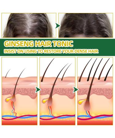 Ginseng Hair Tonic Ginger Hair Care Nutrient Solution Ginseng Hair Essential Oil Hair Growth Serum Spray Hair Growth for Men Women for Activating Dormant Hair and Follicles - Buy Online on GoSupps.com