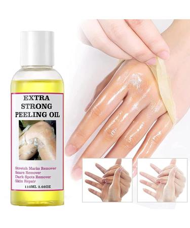 Extra Strong Peeling Oil - Yellow Exfoliating Solution for Body Hands Feet & Face - All Skin Types (110ML - Buy Online on GoSupps.com