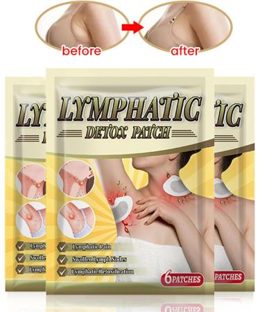 Soins lymphatiques usine de lymphatique des aisselles | Les patchs en relief favorisent la circulation autocollants de ganglions lymphatiques pour les soins corporels des aisselles - Buy Online on GoSupps.com