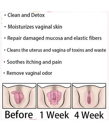 DIZHIGE Anniecare Instant Anti-Itch Detox Slimming Capsules (8 bags) - Effective Relief & Weight Management Solution - Buy Online on GoSupps.com