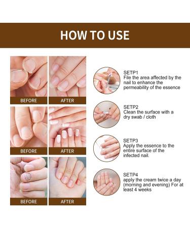 NailGrowth DeepHealing Organic Serum NailGrowth Nail Serum Reconstrux Nail Growth Nail Growth and Strengthening Serum Nail Serum for Growth and Repair for Damaged Nails (3PC) - Buy Online on GoSupps.com