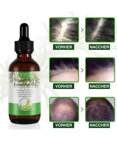 P-Beauty Rosemary Oil | Essential Oil for Hair Growth | Bio & Vegan | Pure Quality | 60ml | Ideal for Scalp Hair & Massage - Buy Online on GoSupps.com