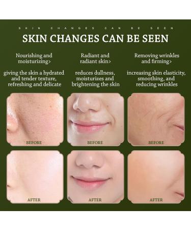 Anti-Aging Skin Care Set | Complete 15-Piece Beauty Kit for Women - Gift for Mom & Wife with Cleanser Toner Lotion & Eye Cream - Buy Online on GoSupps.com