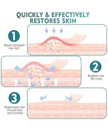 Professional Silicone Scar Sheets Roll 1.6x120 - Effective for C-Section, Surgery, Burns, Keloids - 3M Silicone Tape for Old & New Scars - Buy Online on GoSupps.com