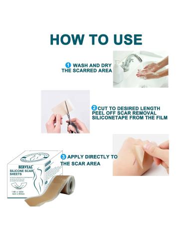 Silicone Scar Tape Roll - Easy-Tear Gel Tape for Surgery Scars - 1.6 x 120 Inch - Medical Grade Silicone Sheets - Wound Dressing for Scar Management - Buy Online on GoSupps.com