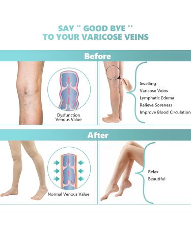 20-30 mmHg Compression Pantyhose for Women | Footless Medical Support Stockings for Varicose Veins & Swelling - X-Large Beige - Buy Online on GoSupps.com