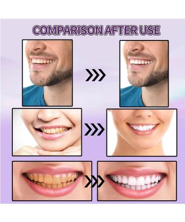 Purple Teeth Whitening Powder - Effective Cosmetic Tooth Cleaning & Whitening for Visible Results - Buy Online on GoSupps.com