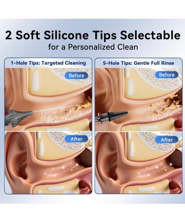 Berrcom Ear Wax Removal Kit with Sanitizing Mode & 6 Nozzles - Upgraded Electric Ear Cleaner and Irrigation System 3 Pressure Settings One-Piece Tank IPX7 Waterproof USB-C - Buy Online on GoSupps.com
