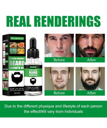 2PCs Beard Growth Oil & Serum for Men | Bart Oil with Biotin - Accelerate Hair Growth - Buy Online on GoSupps.com