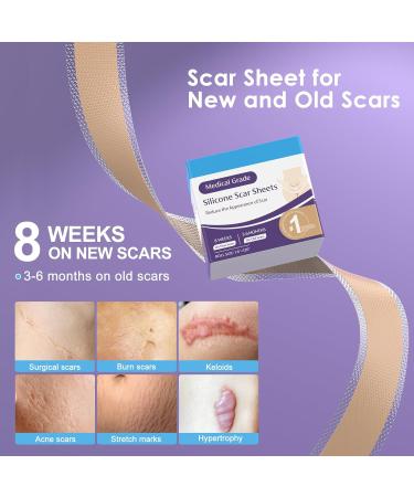 Skiennix Silicone Scar Sheets 1.6 x 120 Roll-3M | Medical Grade Reusable Scar Tape for Surgical Scars, Keloids, C-Sections | Painless Scar Treatment - Buy Online on GoSupps.com