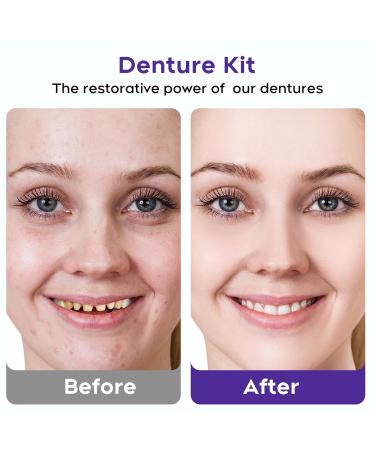 Full Set Fake Teeth Denture Kit - Top & Bottom | Moldable At-Home DIY Temporary Missing Teeth Replacement, Natural Smile Kit-JJ113 Red - Buy Online on GoSupps.com