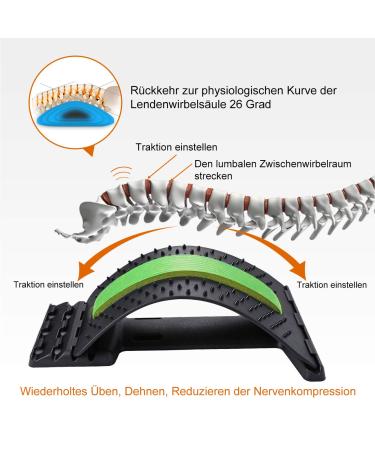 Dyna-Living Magic Back Stretcher - Lordosis Support & Acupuncture Massager for Lower Back Relief - Nonest Corrector - Alleviate Muscle Tension (Black & Green) - Buy Online on GoSupps.com