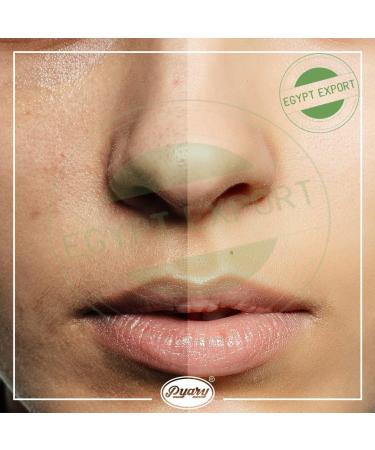 Turmeric Soap Bar - Illuminate Skin & Remove Dark Spots | 12-Pack Bliss | Naturally Crafted Ingredients - Buy Online on GoSupps.com