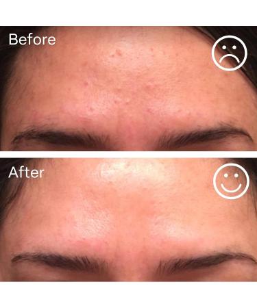 Buy nuorganic Hyaluronic Acid + B5 + Plant Stem Cells - 100 Hour Hydration for Plump Dewy Skin | 7 Days to Better Skin - Buy Online on GoSupps.com