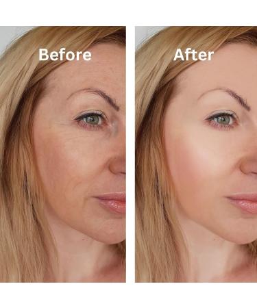 Buy Goody2 Retinol Serum - Anti-Aging Face Serum with Hyaluronic Acid & Vitamin E - 1 fl oz | International Shipping Available - Buy Online on GoSupps.com