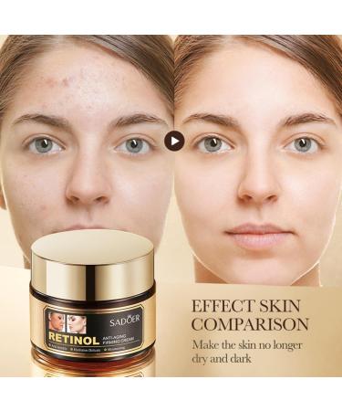 For Sadoer Retinol Facial Creams Lotion.Face Moisturizer Firming Hydrating Facial Cream Facial Skin Care Cream Brighten skin tone.Deeply moisturizing hydrates the skin 50g 1.76 OZ - Buy Online on GoSupps.com
