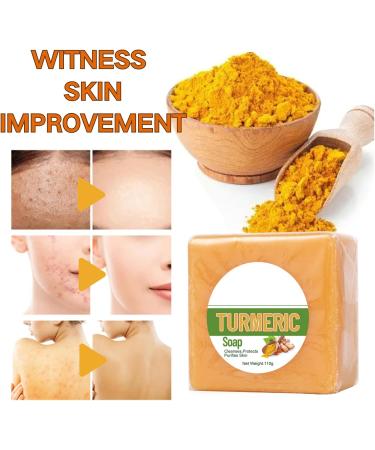 Turmeric Cleaning Soap - Dark Spot Corrector Remover - Natural Soap Bar for Body & Face - Skincare Handmade Soap Bar for Brighten Acne Dark Spots Hyperpigmentation Smooth Skin - Buy Online on GoSupps.com