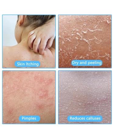 Buy Gjinxi Peeling Gloves & Back Scrubber - 2 Piece Washcloth Set for Exfoliation & Bathing Accessories (Blue) - International Shipping Available - Buy Online on GoSupps.com