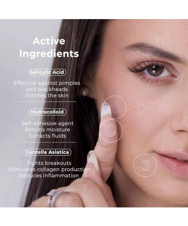 OMMA Pimple Stickers - Hydrocolloid Acne Treatment | 72 Korean Zit Patches with Salicylic Acid for Spot Treatment & Whitehead Extraction - Buy Online on GoSupps.com