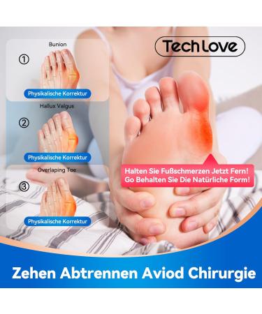 Tech Love Toe Spreader: 4 & 20 Pack Adjustable Silicone Separator for Hallux Valgus Correction - Large Size for Men - Buy Online on GoSupps.com