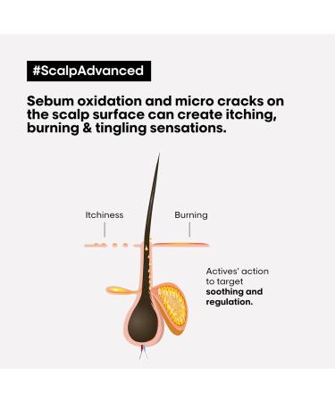 L'Or al Professionnel Scalp Advanced Anti-Discomfort Hair Treatment 200ml for Sensitive Scalps, Serie Expert - Buy Online on GoSupps.com