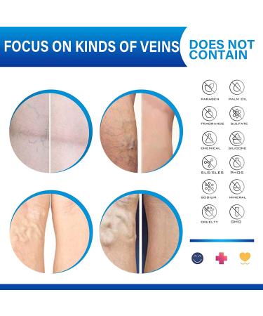Varicose Veins Cream - Natural Treatment for Legs, Improve Blood Circulation, Strengthen Capillaries & Relieve Tired Legs - Buy Online on GoSupps.com