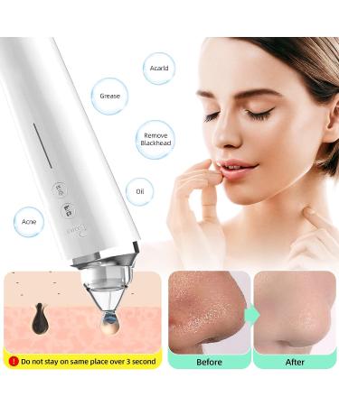 PSKMKS Blackhead Remover Vacuum with Camera 2021 | USB Rechargeable Facial Pore Cleaner with 5.0 MP Visual | Acne Comedone Extractor Tool for Women & Men - Buy Online on GoSupps.com