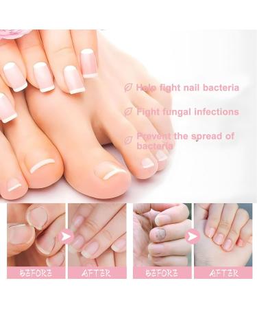 Saluaqui Nail Cuticle Care Kit Strengthens Weak Nails Trimming Tool Included Cuticle Remover Kit Safe Ingredients Easy to Use for Nourishing and Hydrating for DIY Nail LS152-2 - Buy Online on GoSupps.com