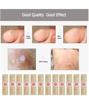 MQ 36 Pcs Corn Removal Pads for Foot Corn, Toe Corn, Callus Removal - Stops Wart Regrowth & Provides Pain Relief - Foot Care (36 Count) - Buy Online on GoSupps.com