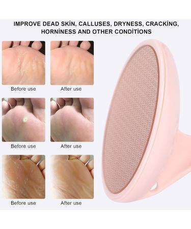 Premium Glass Foot File Callus Remover - Stainless Steel Pedicure Tool for Effortless Heel Care - Nano Crystal Foot File - Pink - Buy Online on GoSupps.com