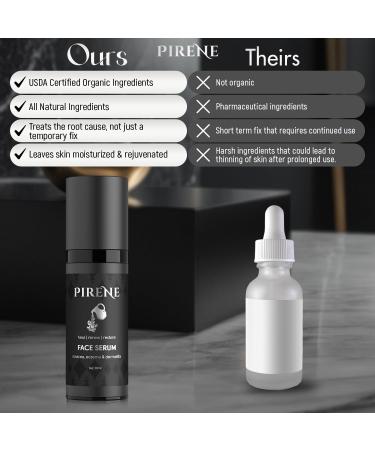 Pirene Organic Face Serum - Redness Relief Moisturizer for Dry Sensitive Skin Rosacea Eczema & Dermatitis | 1.0 fl oz Exfoliating Lotion - International Shipping Available - Buy Online on GoSupps.com