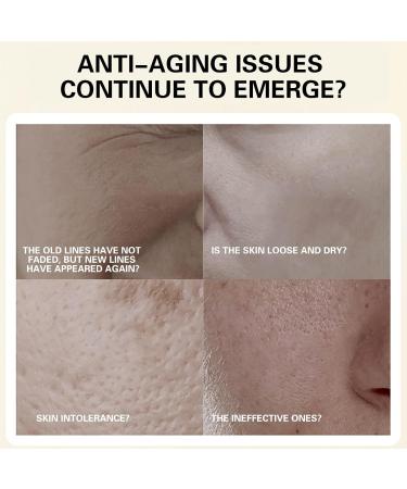  Generisch Qingling Set of 3 Japanese Anti-Wrinkle Creams Qingling Anti-Wrinkle Cream with Japanese Moisturizing Polypeptide Qingling Anti-Wrinkle Face Cream - Buy Online on GoSupps.com