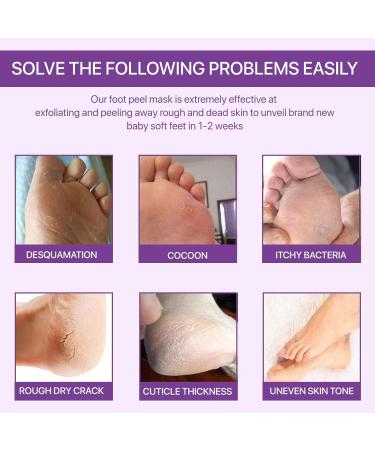 3 Pack Foot Peel Mask Exfoliating Foot Socks Calluses Remover Dead Skin Aloe Moisturizing Feet Peeling Mask for Dry Skin Cracked Heels Foot SPA Socks for Women and Men Lavender - Buy Online on GoSupps.com