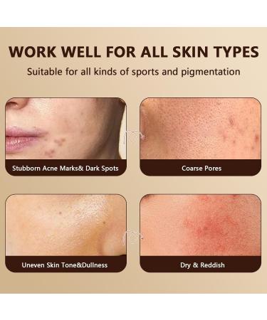 Dark Spot Remover Serum for Face & Body | Age Spot Sun Spot Freckles Brown Spot Corrector for Men & Women - 30ml - Buy Online on GoSupps.com