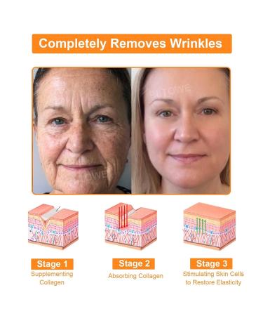 dooeka ADNOON 7-Day Multi-Effect All-in-One Skincare Cream Professional Bee Venom Skincare Cream All-in-One Skincare Cream Fine Line and Wrinkle Correction Cream for All Skin Types (2 Bottle) - Buy Online on GoSupps.com