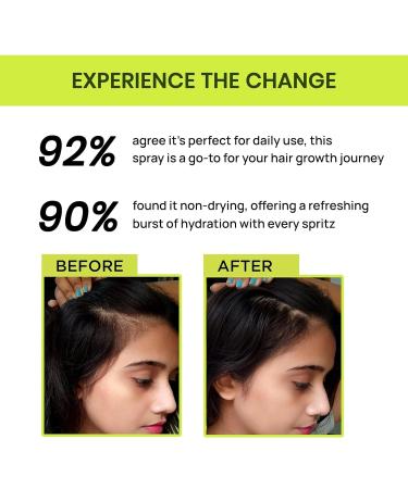 Alp.s Goodness Rosemary Water Spray For Hair Growth (200 ml) | Hair Spray for Regrowth | Rosemary Hair Mist | Adds Shine | Helps Reduce Hairfall | Strengthens Hair | Suitable For All Hair Types - Buy Online on GoSupps.com
