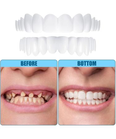 Brigtviee Clipin veneers 2 pairs of instant veneers upper and lower dentures Confidence Smile prostheses comfortable veneers for men and women - Buy Online on GoSupps.com