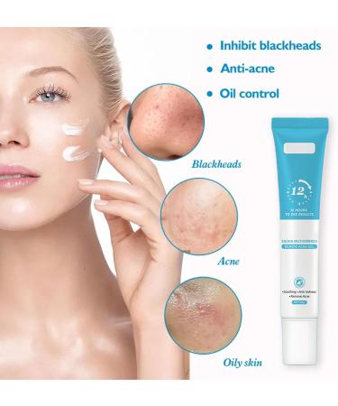Acne Treatment Cream Spot Treatment Acne Cream Soothing & Anti redness Excellent Osmotic Force for All Kinds of Acne and Pimples White Head Inflamed Hardened Encysted Acnes Water-Oil Balance - Buy Online on GoSupps.com